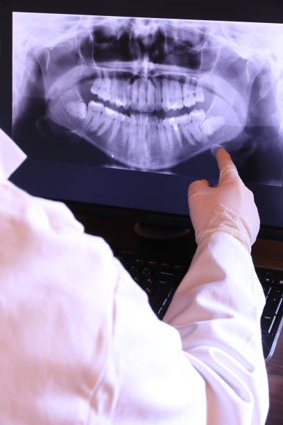 Best Emergency Tooth Extraction in Sterling City, TX