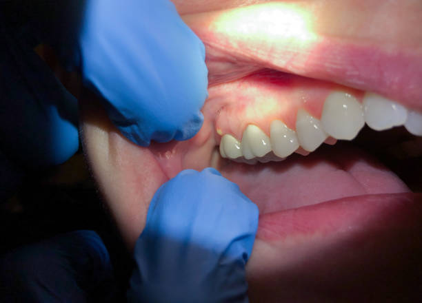 Best Urgent Care for Lost Fillings or Crowns in Sterling City, TX